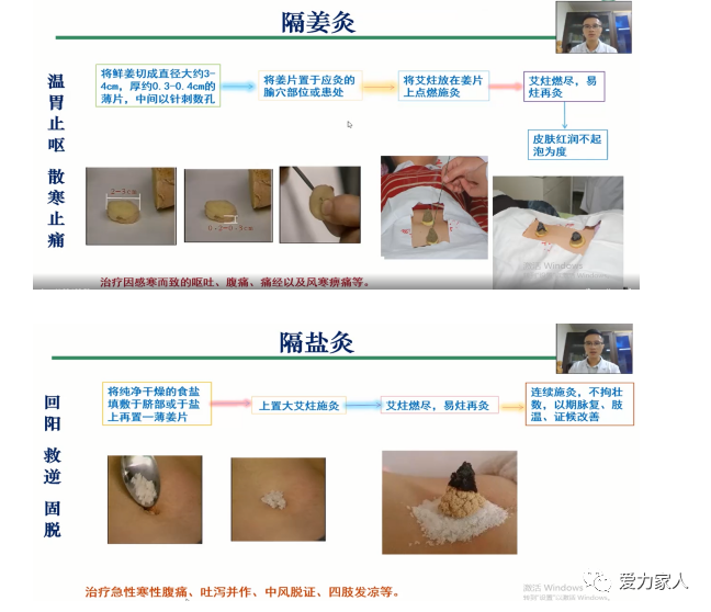艾灸吧】艾灸你该知道的二三事_北京爱力重症肌无力罕见病关爱中心